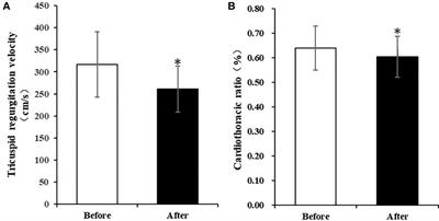 His-Purkinje system pacing reduced tricuspid regurgitation in patients with persistent atrial fibrillation after left-sided valve surgery